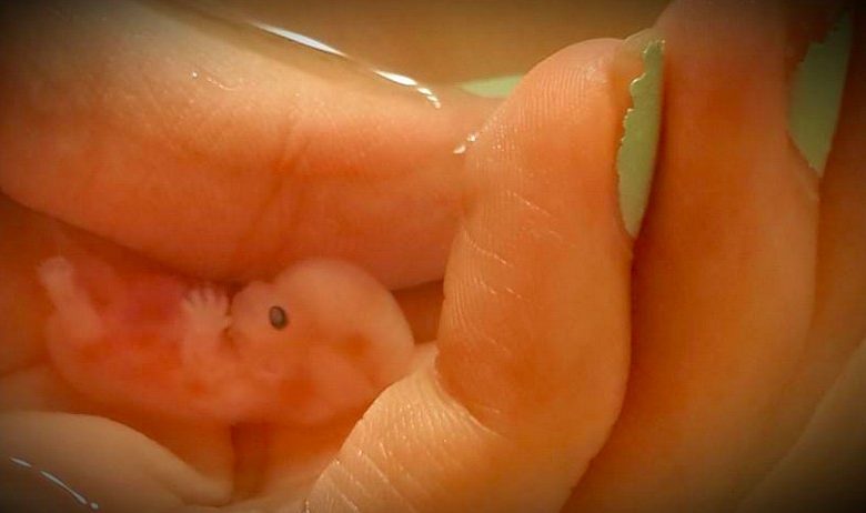 Annabelle-at-8weeks.jpg