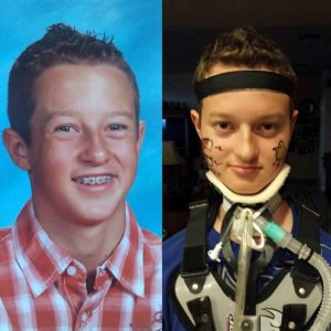 Colton-Berrett-Before-After-HPV-Vaccine