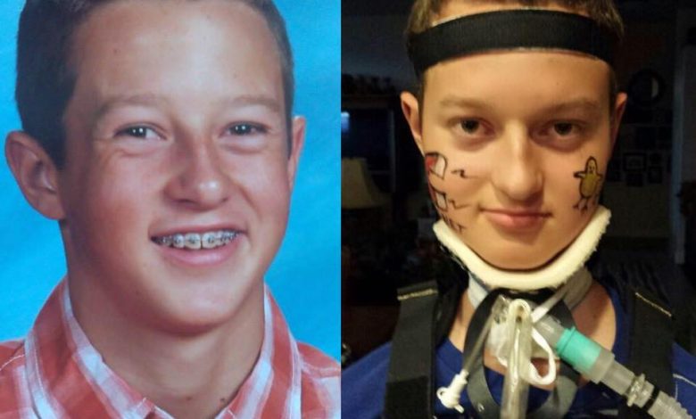 Colton-Berrett-Before-After-HPV-Vaccine
