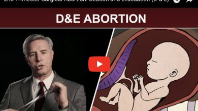 D&E-Abortion