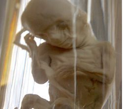 Gosnell-Fetus