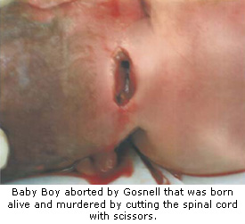 gosnell