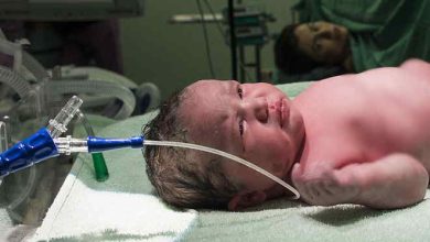 Newborn Baby with Tube