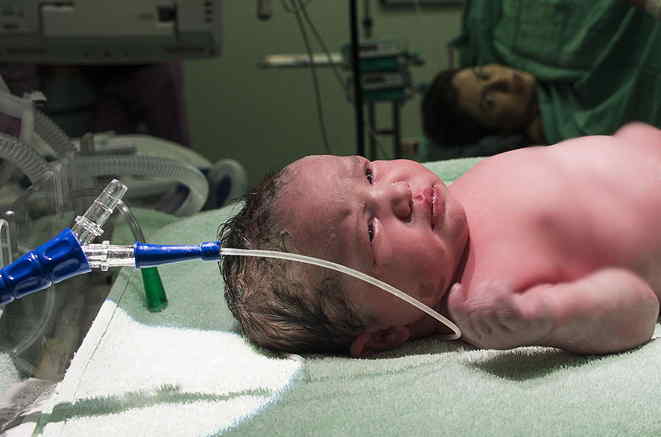 Newborn Baby with Tube