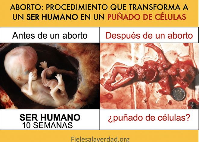 ¿Puñado de Células?