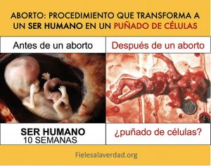 Aborto: Procedimiento que Transforma a un Ser Humano en un Puñado de Celulas