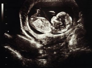 ultrasound-laws.jpg