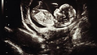 ultrasound-laws.jpg