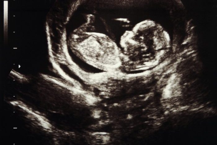 ultrasound-laws.jpg