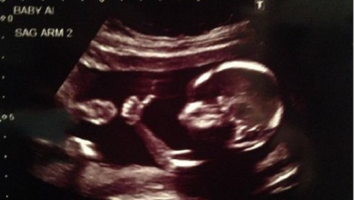 ultrasound