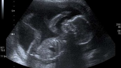 Unborn baby at 20 weeks
